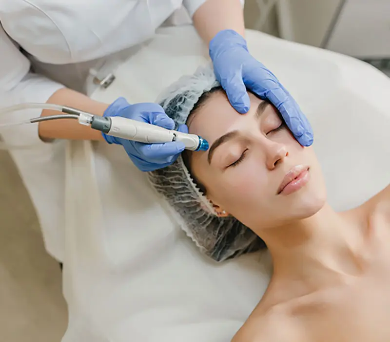 mesotherapy for skin procedure