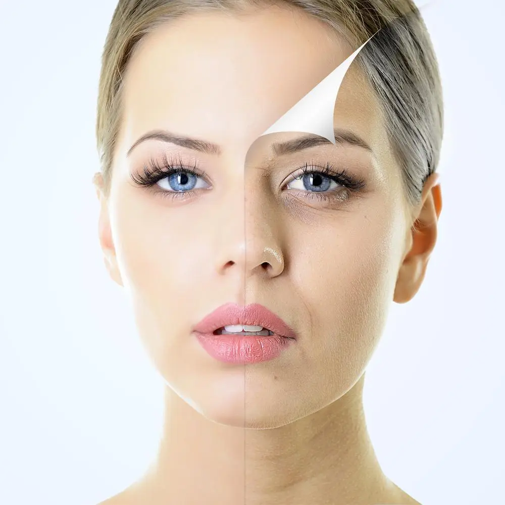 dermal fillers treatment in pune at bodysutra clinic