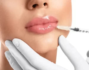 dermal fillers treatment