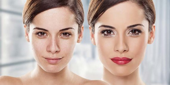 The Secret Of Flawless Skin How Dermal Fillers Treatment Can Transform