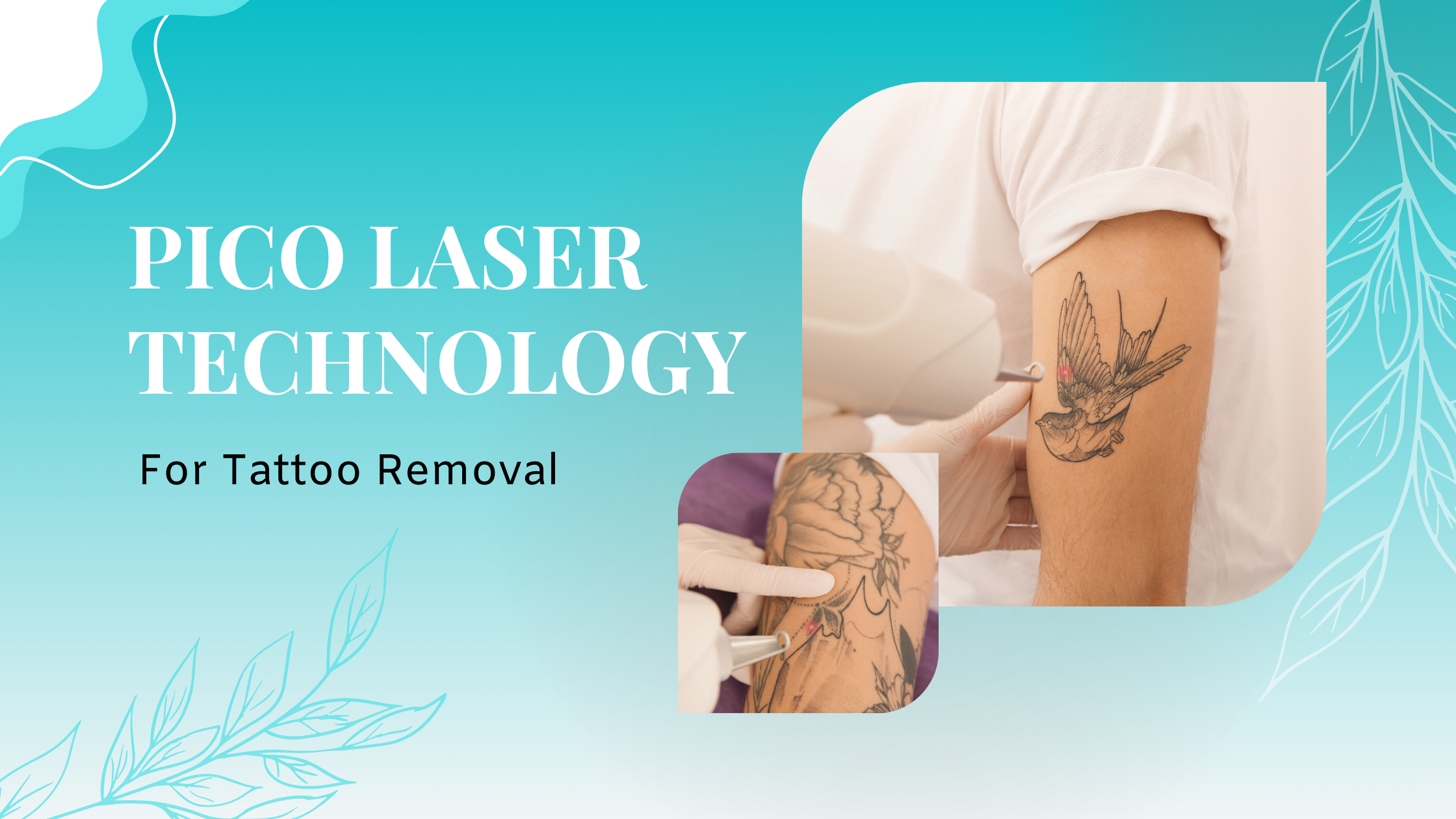 beyond-speed-why-pico-laser-technology-is-a-game-changer-in-laser-treatments- blog banner- image