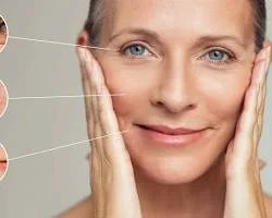 Wrinkles and Fine Lines on Skin