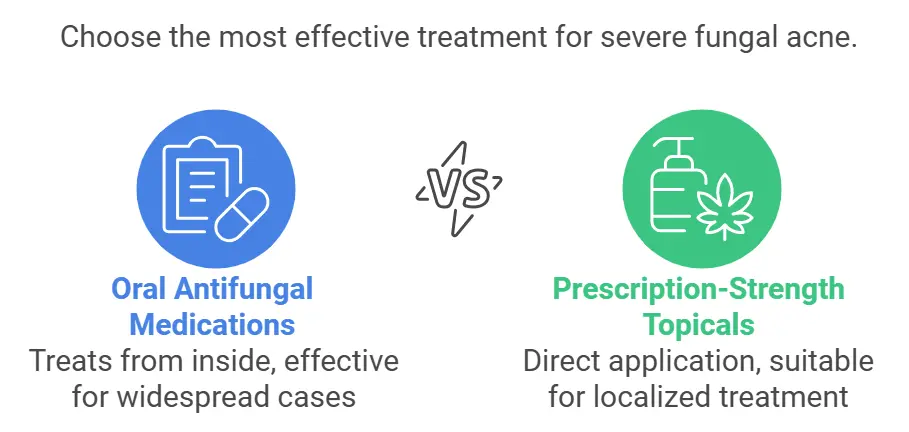 Prescription Treatments for fungal acne