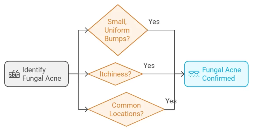 Symptoms of Fungal Acne