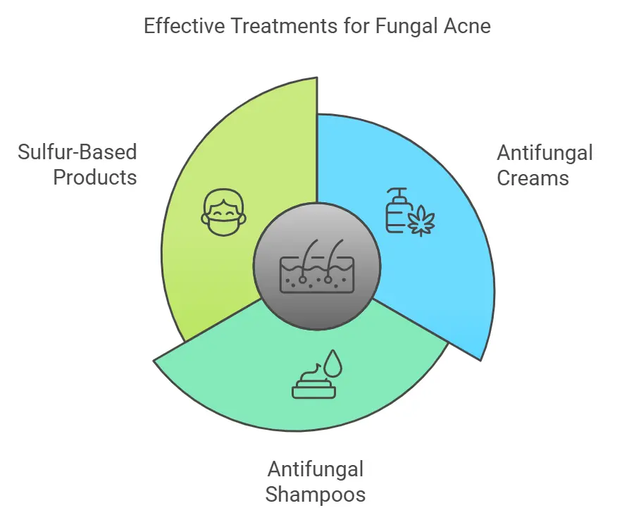 treatments for fungal acne